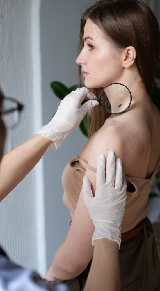 Skin Tag Excision Treatment